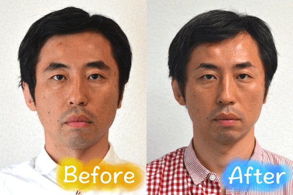 before after